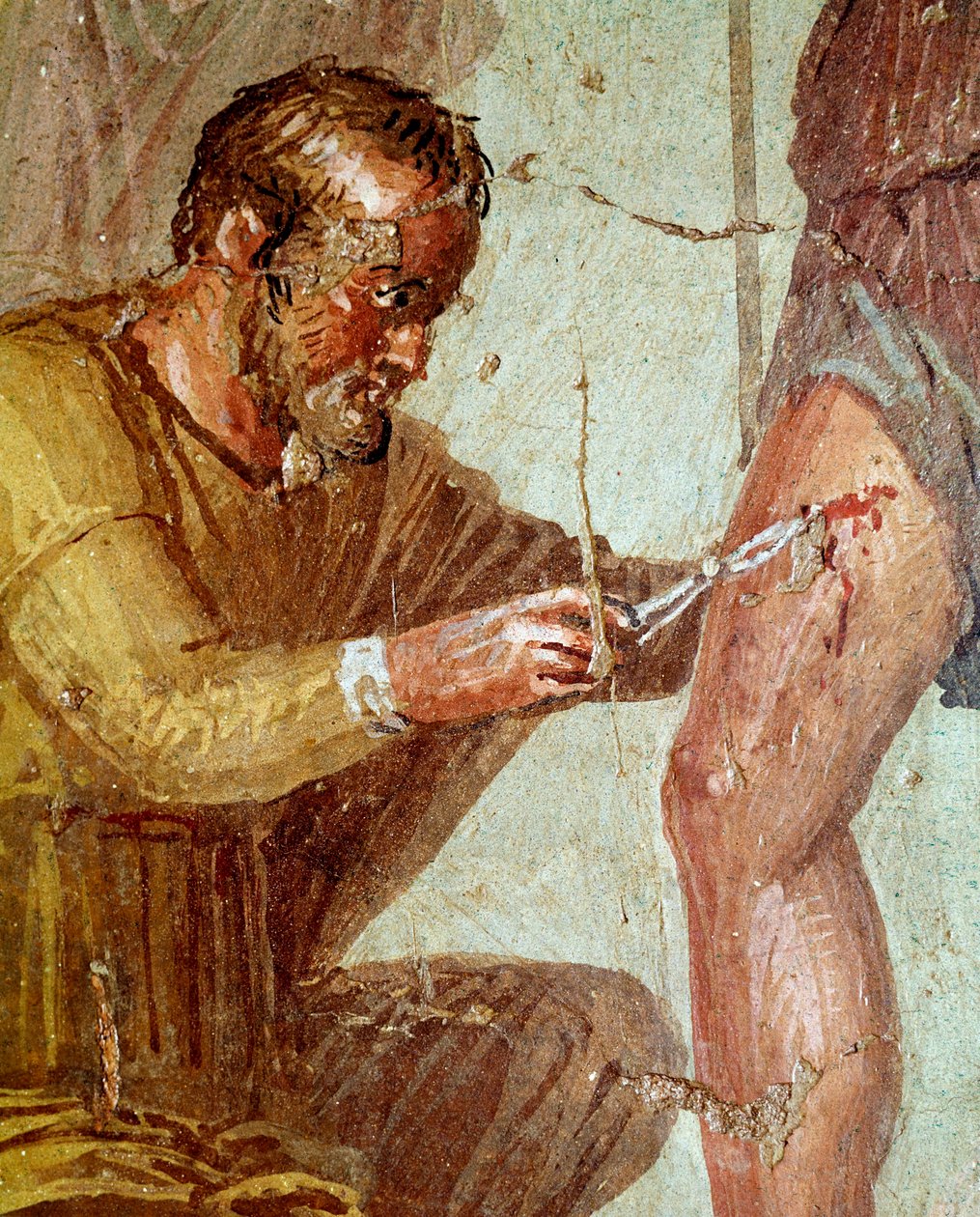 Gewonde Aeneas wordt behandeld door Iapyx geholpen door Venus door Roman