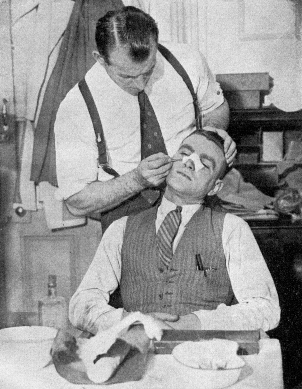 Engeland aanvoerder Eddie Hapgood krijgt behandeling voor een gebroken neus na een wedstrijd met Italië, 1934 door Topical Press Agency