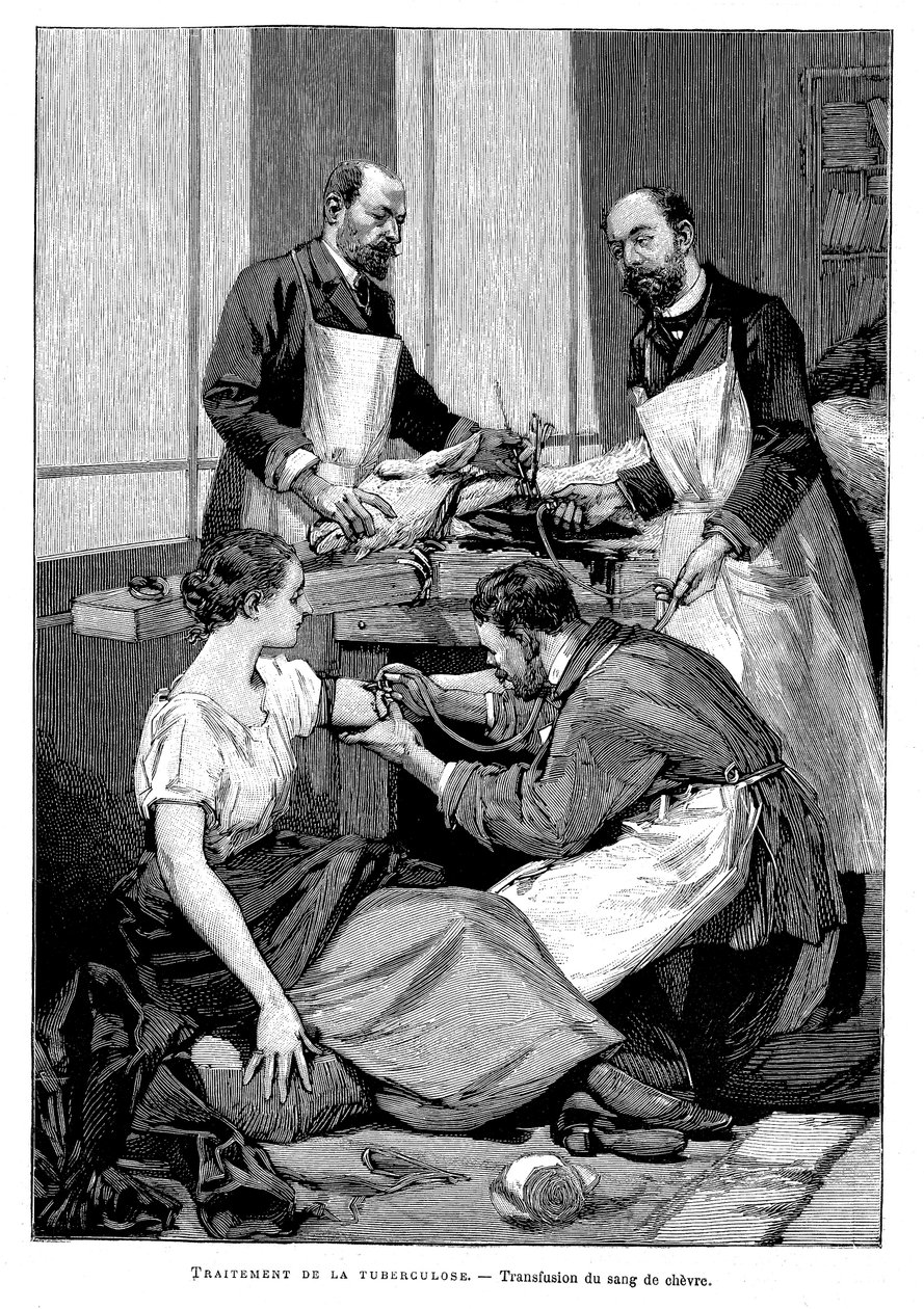 Een tuberculosepatiënt krijgt een transfusie van geitenbloed, 1891 door Unbekannt