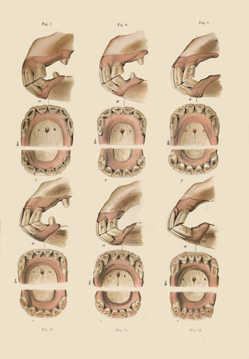 Beschrijving van plaat die de leeftijd aangeeft, zoals aangegeven door de tanden, c1879 door Unbekannt