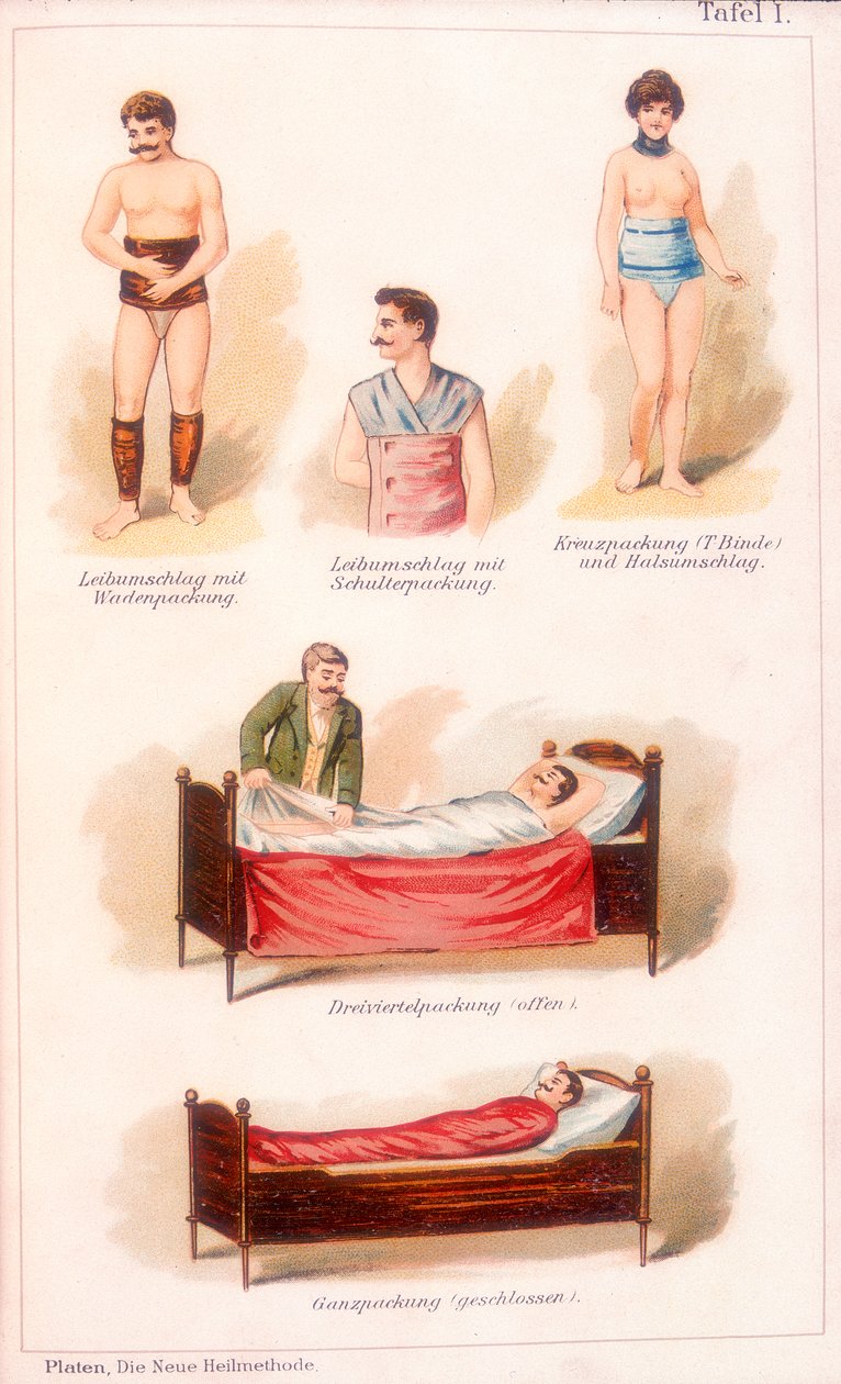 Hydrotherapie behandelingen, ca. 1902 door Unbekannt