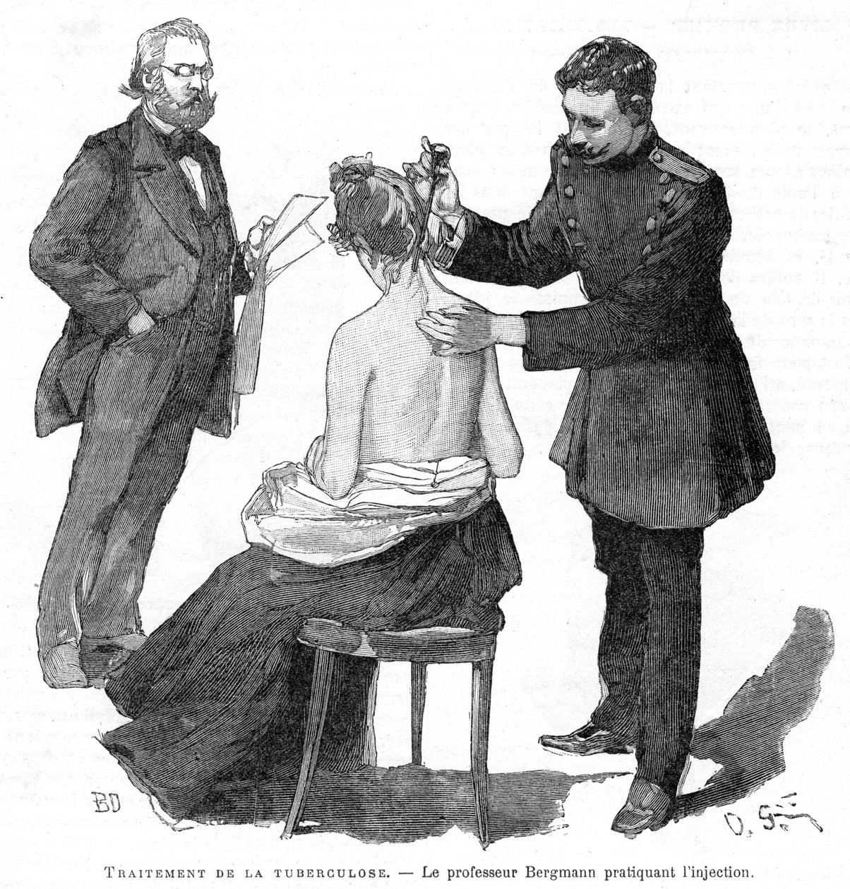 Professor Bergmann injecteert een tuberculosepatiënt, 1891 door Unbekannt