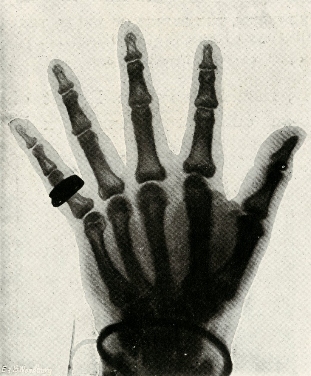 Röntgenfoto van de hand van Z.K.H. De Prins van Wales, c1897 door Unbekannt