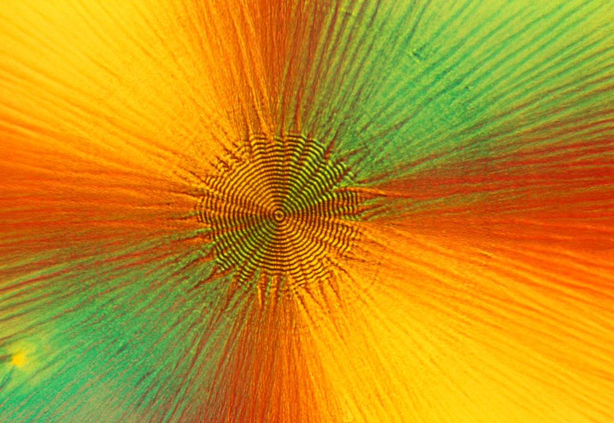 Micrografie (Licht) Ascorbinezuur, licht micrografie door Unbekannt
