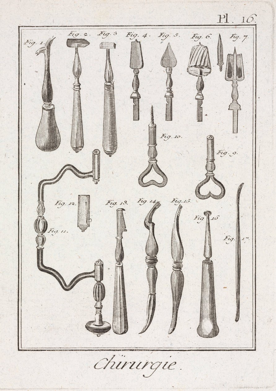 Trepanatie Trepanatie-instrumenten door Unbekannt