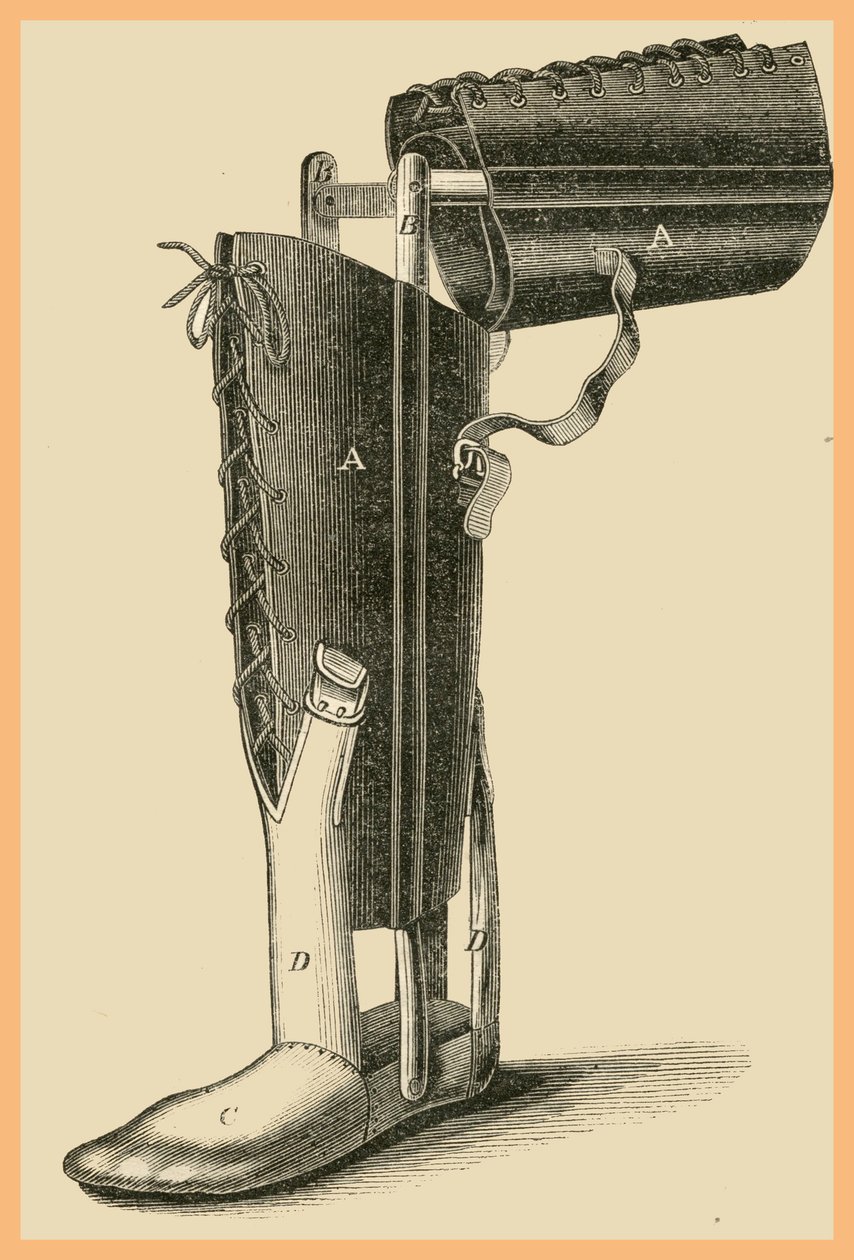 Been vervanging door Unknown Artist