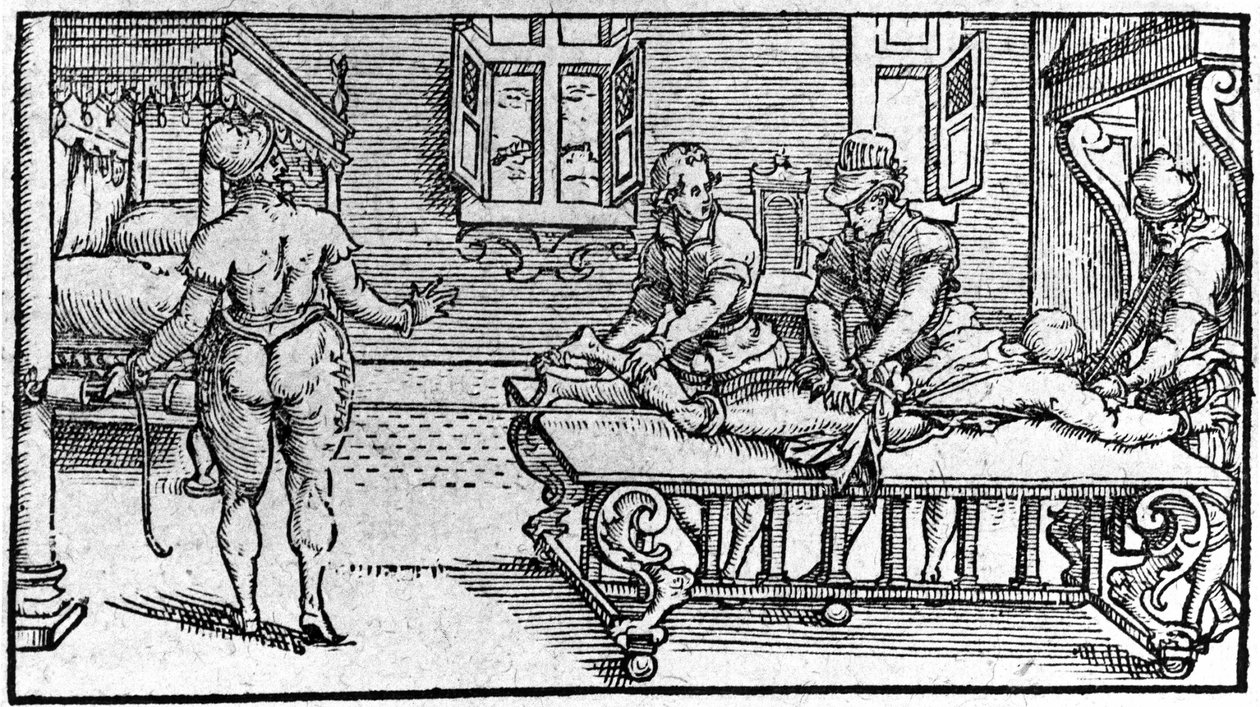 Reductie van een ontwrichting, in "Traité Médical" door Ambroise Paré, circa 1560 door Unknown artist