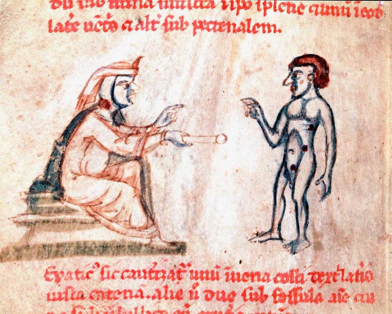 De dokter brandt de patiënt op pijnlijke plekken met hete ijzers, miniatuur uit het manuscript 