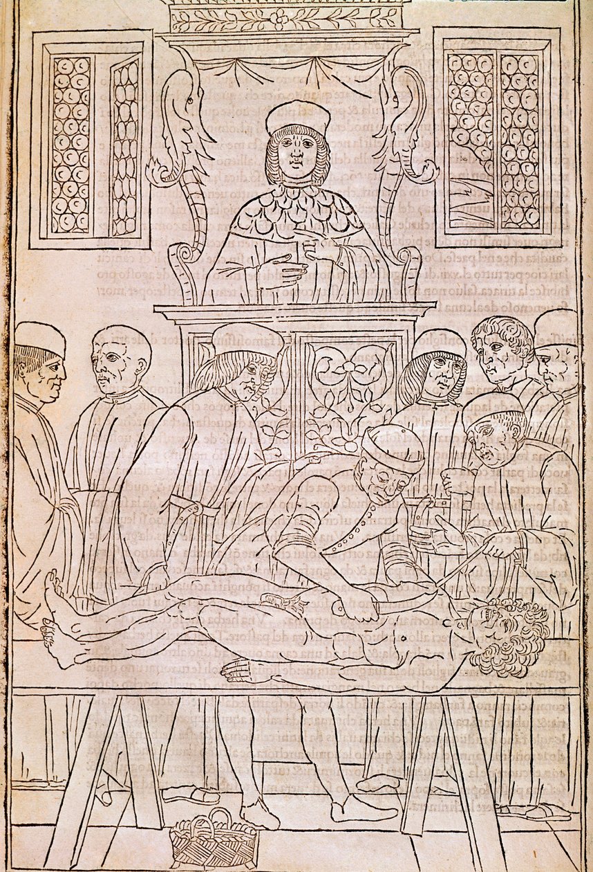 Autopsie. Codex. Het lichaam van een dode man ontleed door artsen voor een anatomische studie. 