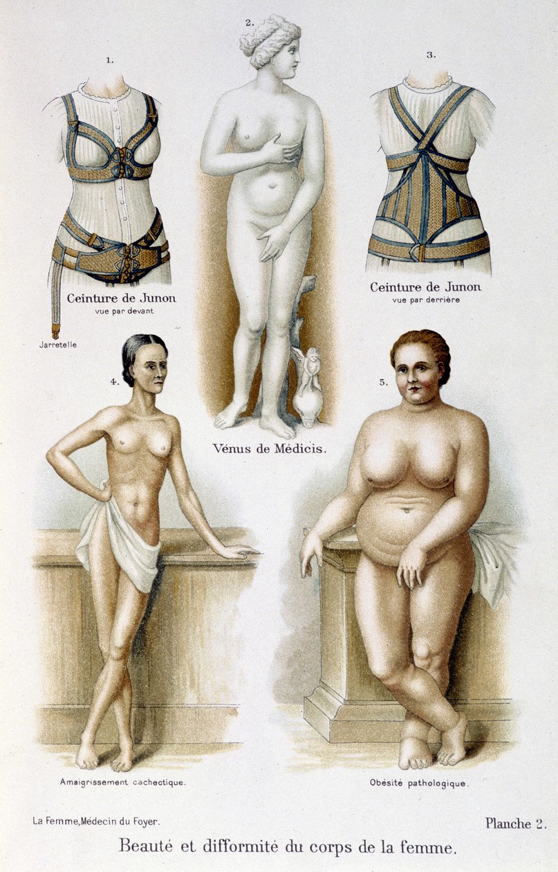 Schoonheid en misvorming van het vrouwenlichaam (mager en obesitas); Juno