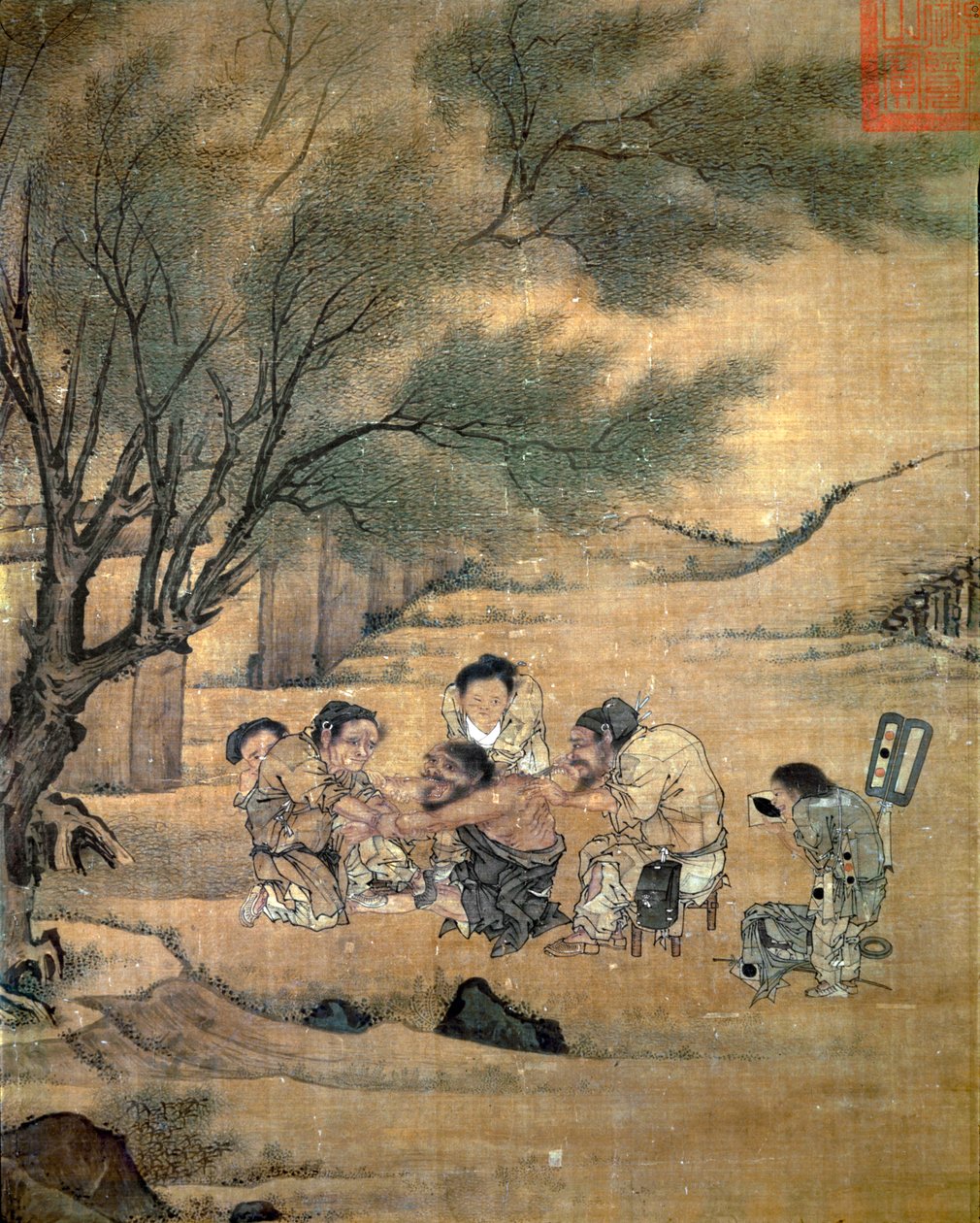 Een arts op het platteland past een pijnstillende moxibustiebehandeling toe (traditionele Chinese medische therapie die gebruik maakt van speciale door Unknown artist