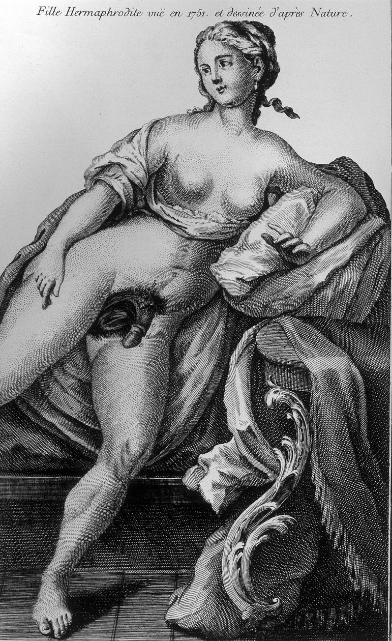 Hermafrodiete meisje gezien in 1751 en getekend naar de natuur door Unknown artist