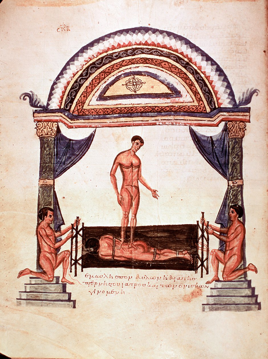 Geneeskunde: reductie van een ontwrichte wervelkolom - patiënt is vastgemaakt op een houten plank, een van de therapeuten staat op zijn rug (manuscript) door Unknown artist