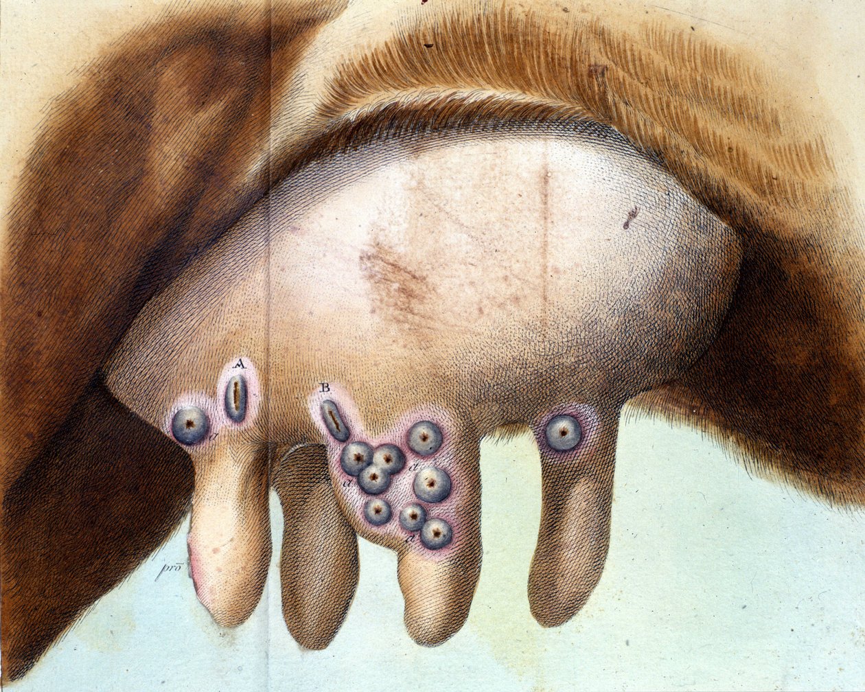 De uier van de koe gebruikt om het pokkenvaccin in te enten door Luigi Sacco (1769-1836) in januari 1801. Medische plaat uit 
