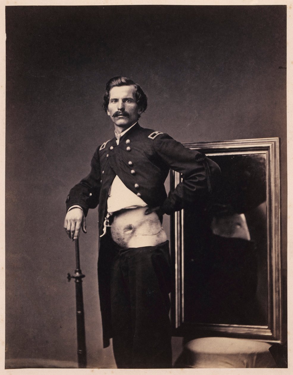 Majoor H.A. Barnum, Herstel na een doordringende schotwond in de buik met perforatie van de linker keelholte, uit de fotocatalogus van de afdeling Chirurgie door William Bell