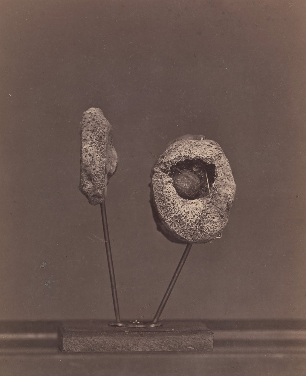 Uitgesneden kniegewricht. Een ronde musketbal in de binnenste condyl van het rechterdijbeen [Gardin..., 1866-67 door William H. Bell