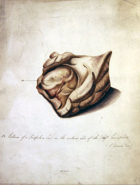 Studie van de Hersenen II, c.1850 door William Lover