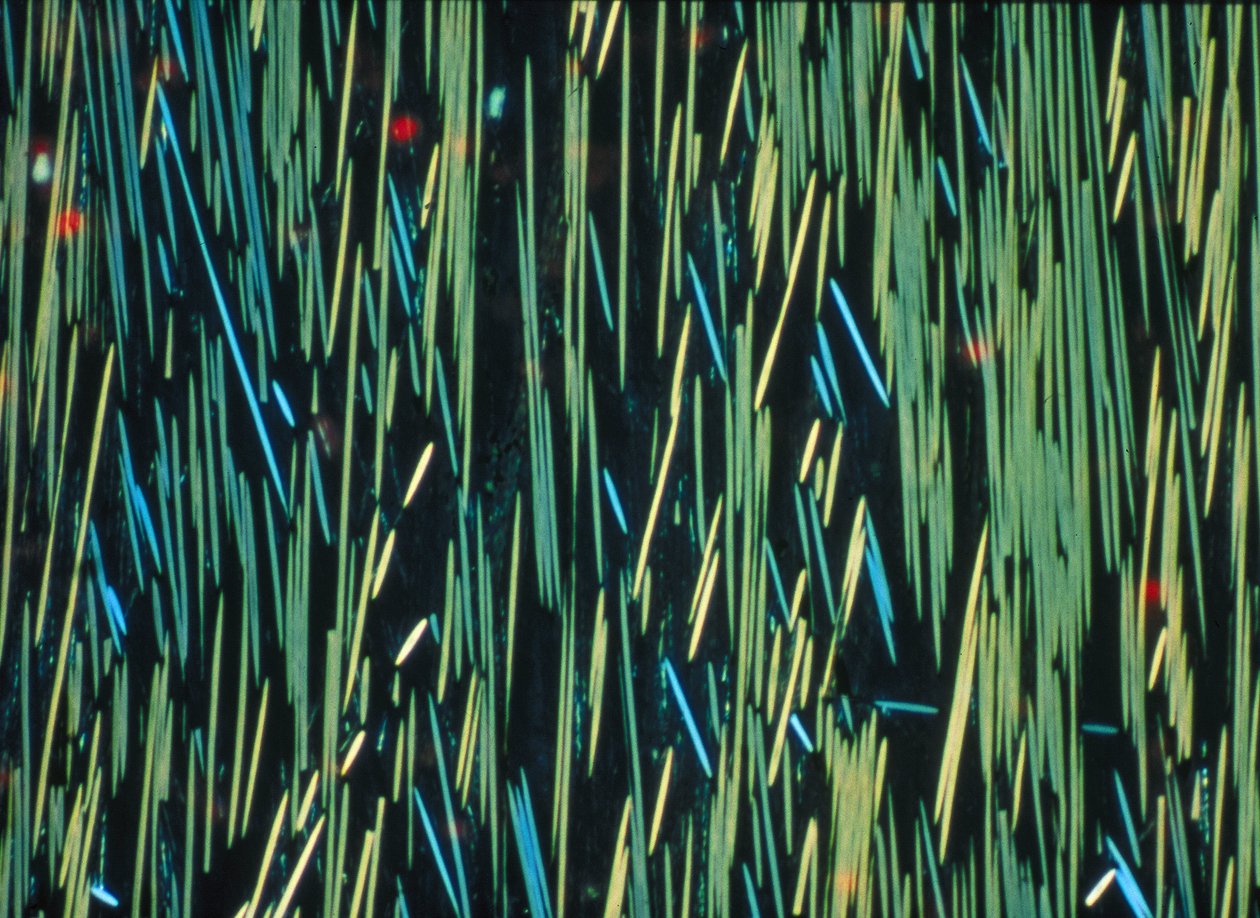 PMC koolstofvezel in een polymeermatrix door Frederick (attr. to) Barnard