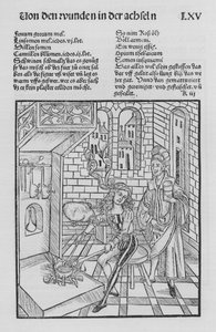 Het boek van Cirurgia door Hieronymus Brunschwig