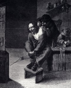 De chirurgische operatie Gravure naar een schilderij van Adrien Brauwer (overleden 1608) 17e eeuw door Adriaen (after) Brouwer