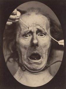 Electro-Physiologie, figuur 64, 1854-56, gedrukt 1862