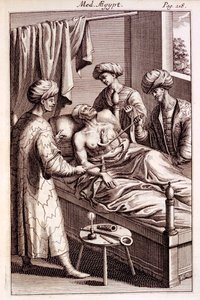 Illustratie van moxibustie uit Medicina Aegyptorum door Prospero Alpinus, 1745 door American School