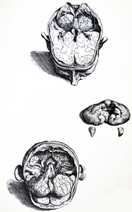 De Platen uit het Zevende Boek van de De Humani Corporis Fabrica door Andreas Vesalius