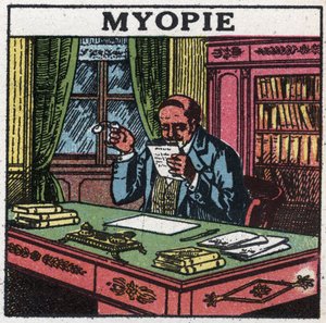 Het oog: persoon die lijdt aan bijziendheid. Anonieme illustratie uit 1925. Privécollectie.