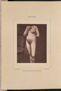 Gegeneraliseerde vesiculaire syfilis door Arthur de Montmeja