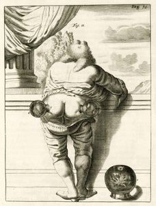 Een voorbeeld van koppen, uit Exercitationes Practicae circa Medendi Methodum door Frederik Dekkers, 1694 door Dutch School