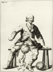 Aftappen van vocht uit een hydrocele van het scrotum, uit Exercitationes Practicae circa Medendi Methodum door Frederik Dekkers, 1694