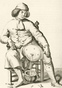 Aftappen van vocht uit een abces, uit Exercitationes Practicae circa Medendi Methodum door Frederik Dekkers, 1694