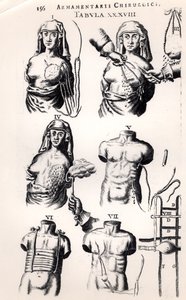 Operatie voor borstkanker, uit Armamentarii Chirurgici door Johannes Schultes (1595-1645) gepubliceerd in Amsterdam, 1672 door Dutch School