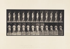 Plaat 542. Meervoudige Cerebro-Spinale Sclerose - Lopen
