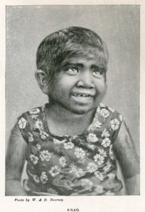 Krao, De Missing Link, tentoongesteld in het Aquarium, Westminster, Londen, in 1887 door English Photographer