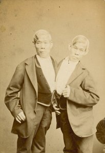 De Siamese jongeren; foto; tentoongesteld in de Egyptian Hall, Piccadilly, Londen
