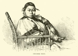 Chinese Voeten