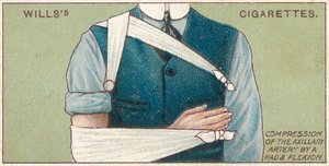Compressie van de okselarterie door een pad en flexie, nr.41 uit de Eerste Hulp-serie van Willss Cigarettes kaarten