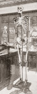 De skeletten van Charles Byrne