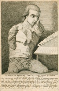 Thomas Inglefield, geboren 18 december 1769 in Hook, Hampshire, zonder armen of benen