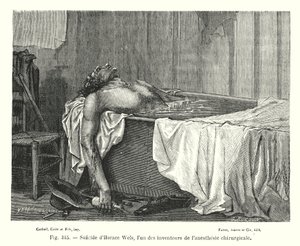 Zelfmoord van Horace Wels, een van de uitvinders van chirurgische anesthesie door European School