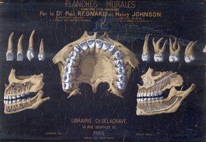 Anatomische wandkaart van de tanden door French School