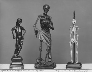 Lijk, skeletten