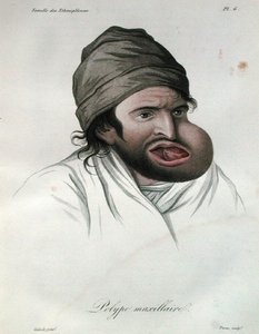 Maxillaire poliep, uit een boek door Baron Jean Louis Alibert 1817 (gekleurde gravure) door French School