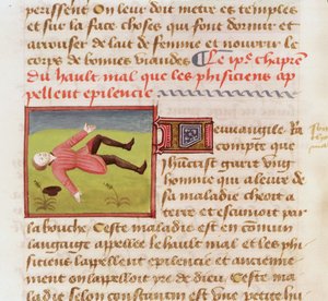 Patiënt die lijdt aan een epileptische aanval, uit Le Livre des Proprietes des choses door Barthelemy l