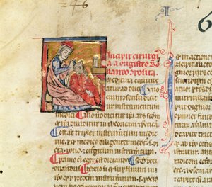 Ms Lat. 7134 fol.1 Trepanatie, uit Chirugie de Maitre Rolandi door French School