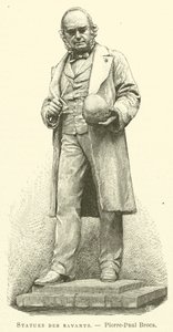 Standbeelden van geleerden, Pierre-Paul Broca door French School