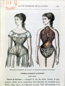 De schadelijke effecten van het korset, illustratie uit La Vie Normale et la Sante door Dr. Jules Rengade (geb. 1841) ca. 1880