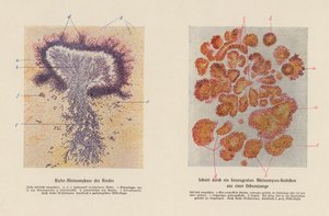 Actinomyces bovis door German School