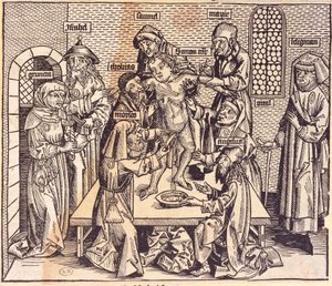 Anatomieles (gravure) door German School
